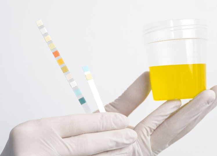 Synthetic Urine – Top 5 Products to Pass a Drug Test